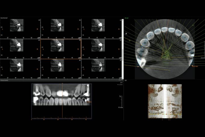 dental-laboratory-london