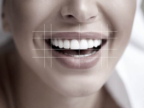 smile-design smile-design