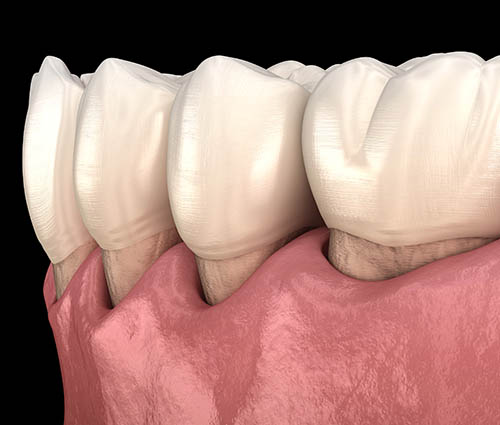 best-periodontal-surgery-croatia