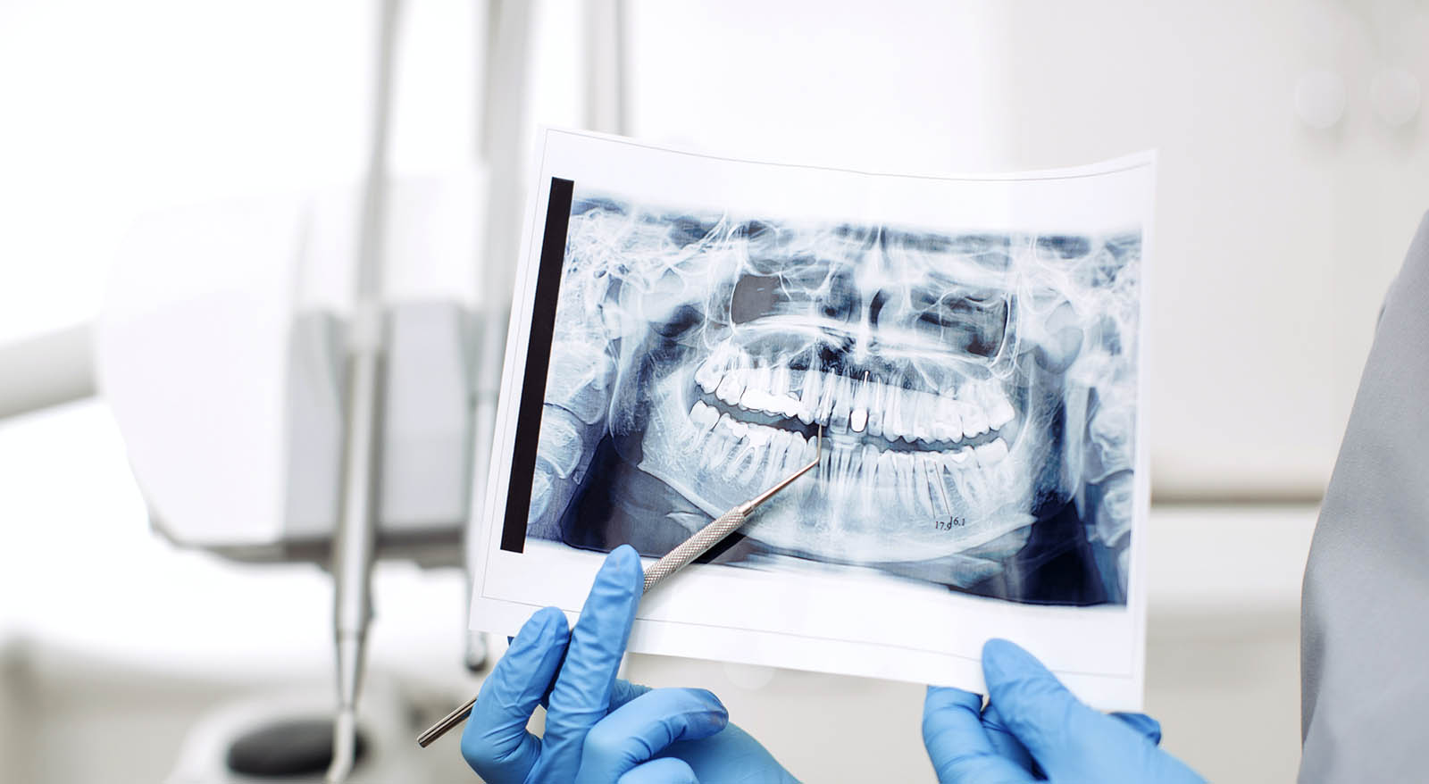 Conservative Dentistry Institute Dentalna Jelušić