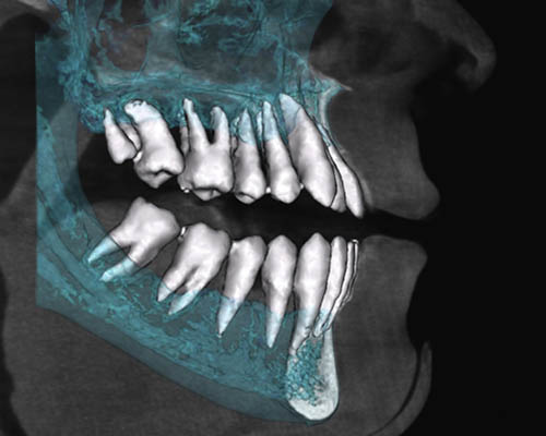 advanced-3d-dental-technology