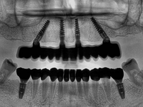 dental-panoramic-images