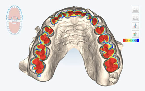 advanced-dental-patient-care