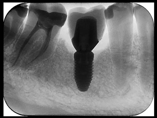 intraoral-dental-imaging